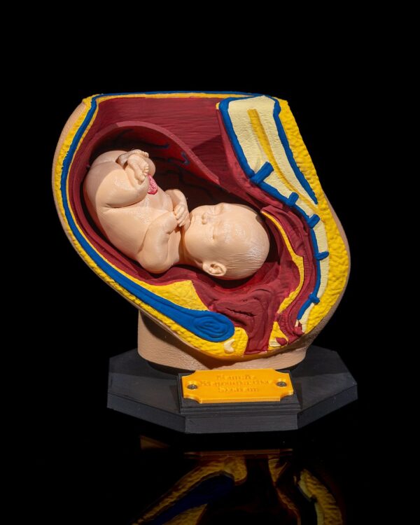 Female Reproduction Model - Educational tool - Image 9