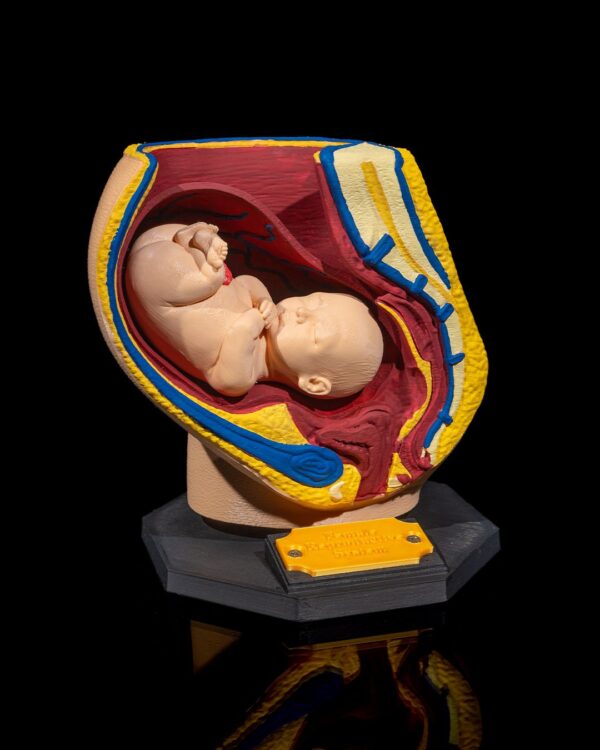 Female Reproduction Model - Educational tool - Image 8