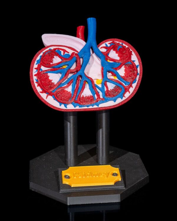 Kidney Model - Educational Tool - Image 10