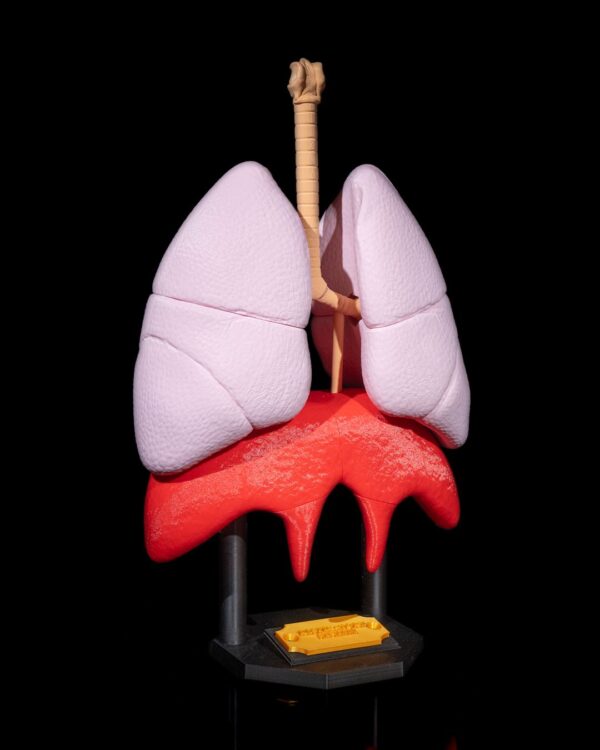 Lung Anatomical Model - Educational Tool - Image 10