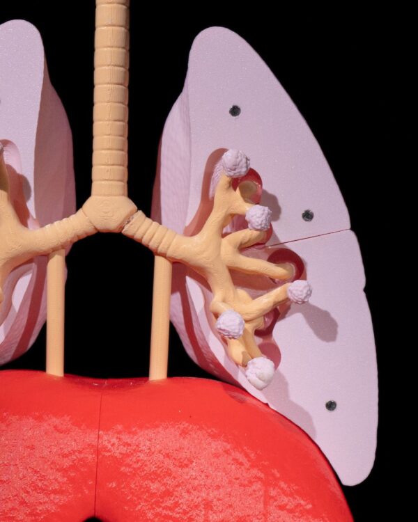 Lung Anatomical Model - Educational Tool - Image 5