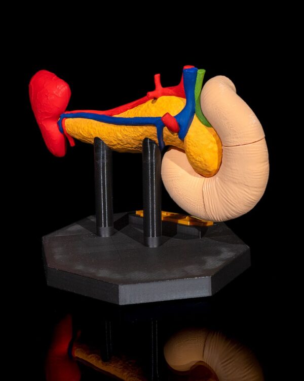 Pancreas Model - Educational Tool - Image 4