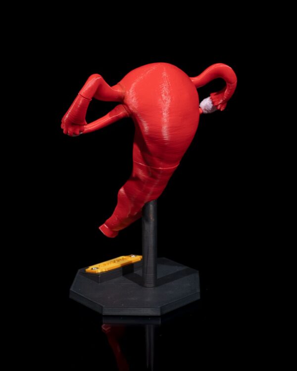 Uterus Model - Educational Tool - Image 4