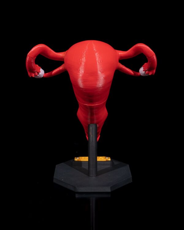 Uterus Model - Educational Tool - Image 3